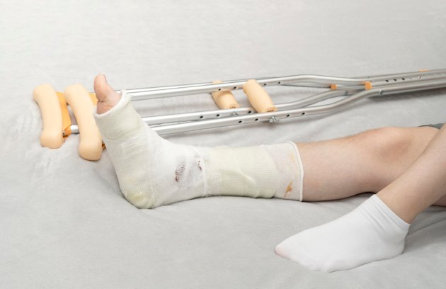 Revisión y seguimiento de fracturas en CDMX