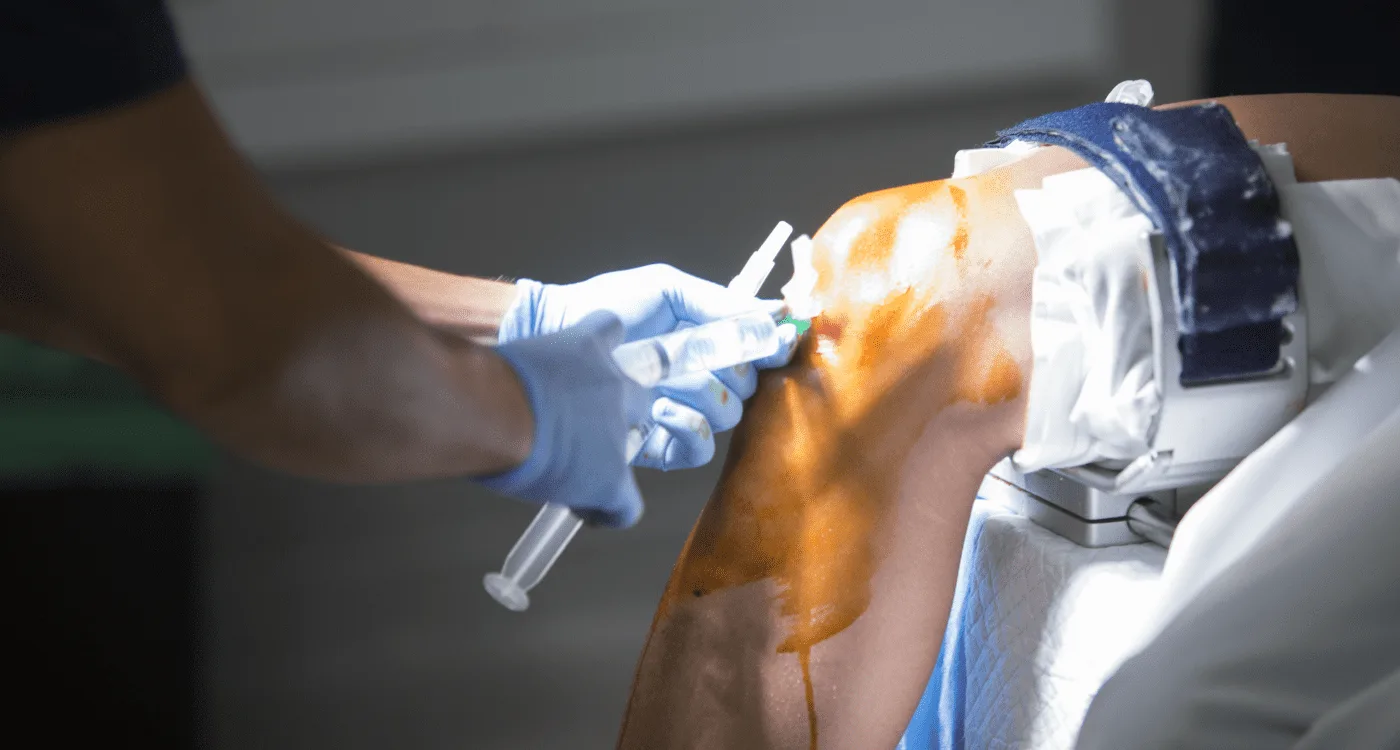 ¿Qué especialista trata el dolor de rodilla?