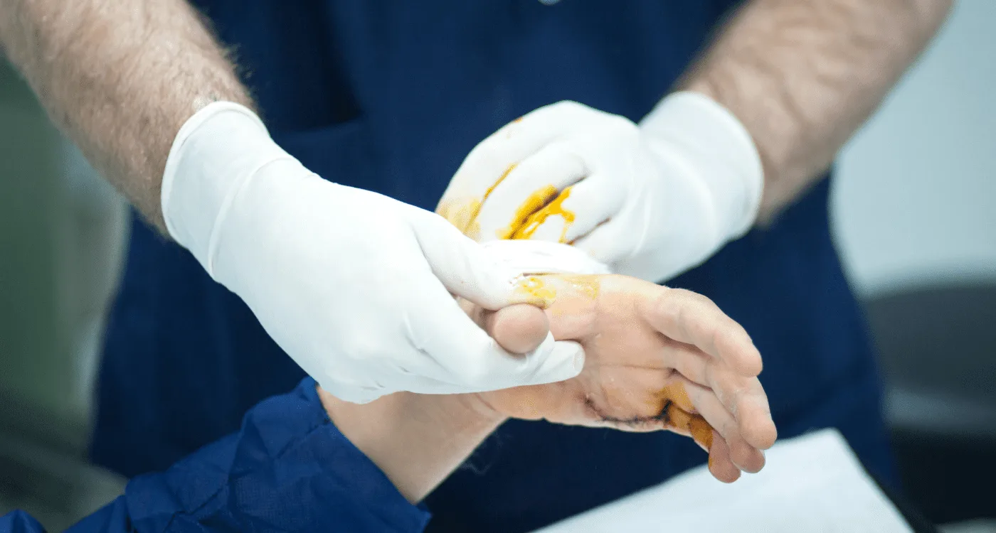 Atención especializada en fracturas y traumatología ósea en CDMX